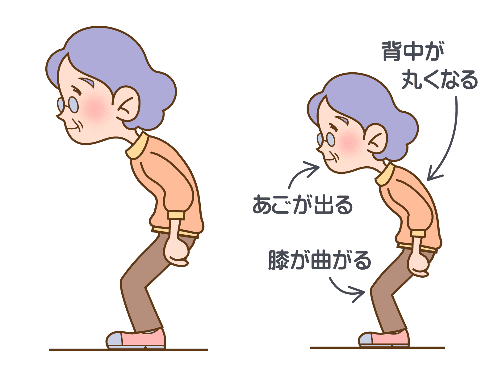 背中が丸くなるとどうなるかのイメージを図にしています
