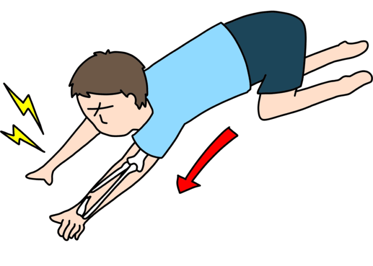転倒して手をついて骨折するイメージのイラスト